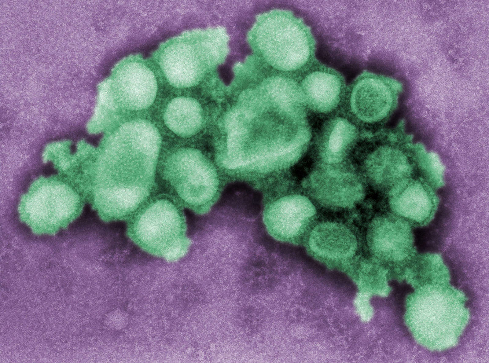 H5N1: The Monoculture Flu
